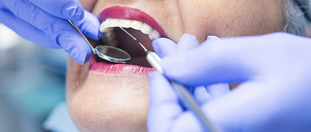 Best Pediatric Emergency Dentist in West Menlo Park, CA